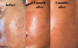angel glow face oil